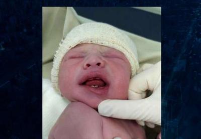 Bebê nasce com dois dentes e surpreende pais