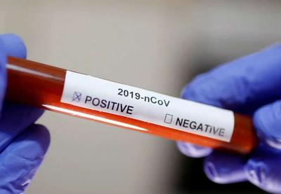 Brasil tem 19 casos confirmados do novo coronavírus