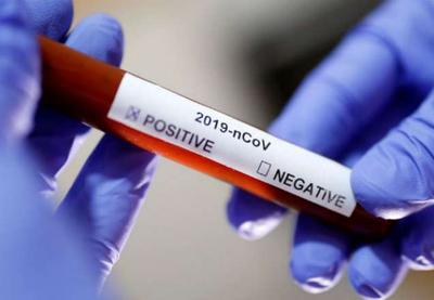 Brasil tem 13 casos confirmados e mais de 700 suspeitos do coronavírus