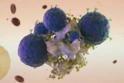 Estados Unidos aprovam primeiro tratamento genético contra leucemia