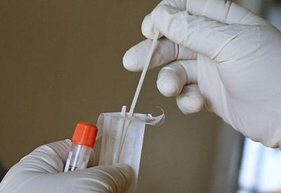 SP inicia dupla testagem para identificar casos de covid e influenza