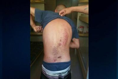 Presos denunciam tortura e más condições em centros de triagem no RS