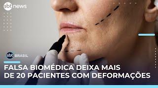 Falsa biomédica deixa mais de 20 pacientes com deformações em Florianópolis (SC) | #SBTBrasil