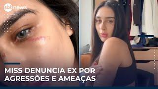 Miss do Amazonas denuncia ex-namorado por agressões e ameaças de morte | #SBTNews Manhã (15/05/25)
