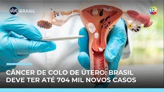 Câncer de colo de útero: Brasil deve ter 704 mil novos casos até o final do ano | #SBTBrasil