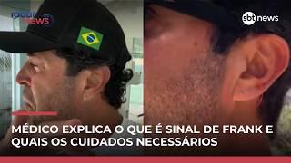 Médico explica qual a relação entre Sinal de Frank e o risco de infarto | #RadarNews