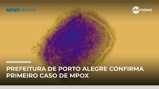 Prefeitura de Porto Alegre confirma primeiro caso de Mpox em 2026