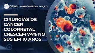 Cirurgias de câncer colorretal crescem 74% no SUS em 10 anos | #NewsPrimeiraEdição