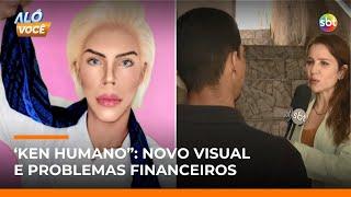 “Ken Humano” enfrenta dificuldades; com novo visual, veja como rapaz está | #AloVoce