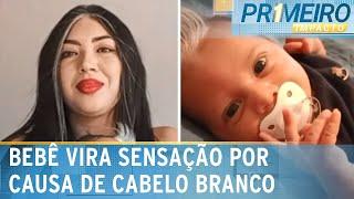 Bebê que nasceu com mecha branca vira sensação no interior de SP | Primeiro Impacto (20/12/24)