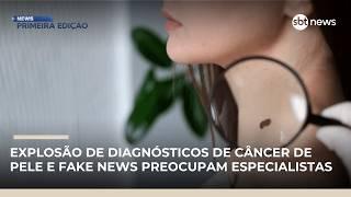 Câncer de pele dispara no Brasil e desinformação sobre protetor solar preocupa | #NewsPrimeiraEdição