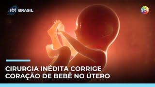 Bebê passa por cirurgia cardíaca dentro do útero em Porto Alegre  | #SBTBrasil