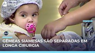 Hospital conclui cirurgia de separação de gêmeas siamesas após 19 horas  | SBT Brasil (11/05/25)