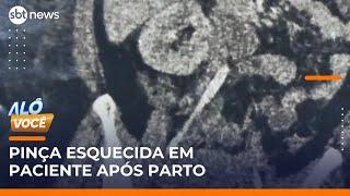 8 anos de luta: Médicos esquecem pinça na barriga de mulher após parto | #AlôVocê (04/06/25)