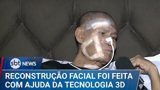 Tecnologia 3D ajuda a reconstruir rosto de paciente com câncer | #SBTNews (26/12/24)