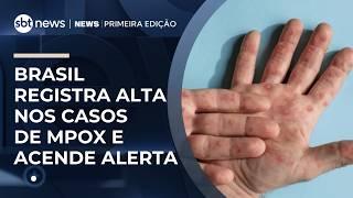 Brasil registra alta nos casos de Mpox e acende alerta em autoridades | #NewsPrimeiraEdição