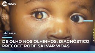 Campanha alerta para diagnóstico precoce do retinoblastoma, câncer raro nos olhos | #SBTBrasil 