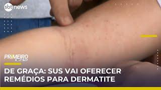 SUS passa a oferecer tratamento gratuito para dermatite atópica | Primeiro Impacto (06/06/25)