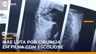 Mãe luta por cirurgia urgente para filha com escoliose grave | #SBTNotícias 1ª Edição (31/05/25)