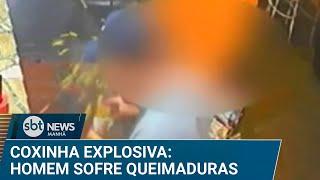 Coxinha explode no rosto e homem sofre queimaduras | #SBTNews Manhã (18/12/24)