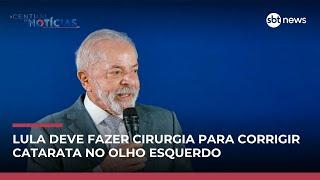 Lula fará cirurgia para corrigir catarata no olho esquerdo nesta sexta (30)