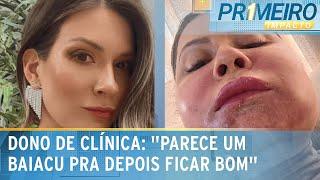 Mulher fica com rosto deformado após procedimento com PMMA | Primeiro Impacto (13/01/25)