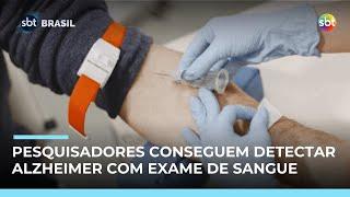Pesquisadores brasileiros desenvolvem exame de sangue para detectar Alzheimer
