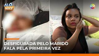 Sobrevivente após ser espancada pelo marido, mulher fala sobre o crime | #AloVoce