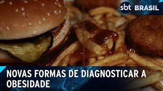 Diagnóstico e definição de obesidade devem mudar: veja por que e o que muda | SBT Brasil (25/01/25)