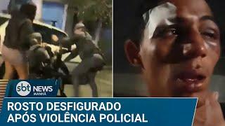 Jovem fica com rosto desfigurado em abordagem; PM cita “força moderada” | #SBTNews Manhã (24/03/25)