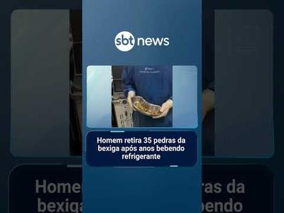 Homem retira 35 pedras da bexiga após anos bebendo refrigerante