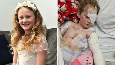 “Achei que ela estava morta”, diz mãe após filha ser atacada por XL American Bully, no Reino Unido 