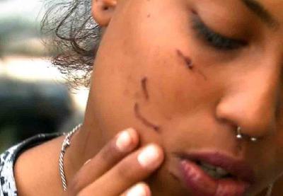Agente de trânsito agredida por casal vai ser indenizada em R$ 15 mil