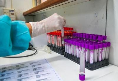 Brasil tem 889 mortes e 25 mil novos casos de covid em 24 horas