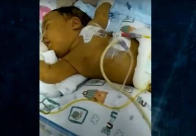 Bebê precisa de transplante que custa R$ 12 milhões