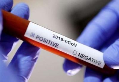 Brasil chega a 57.070 mortes pelo novo coronavírus