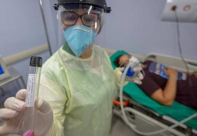 Brasil ultrapassa 3,9 milhões de infectados pelo novo coronavírus