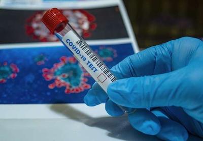 Brasil ultrapassa 22 mil óbitos confirmados por coronavírus