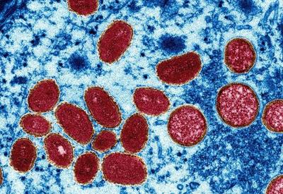 OMS: mundo soma 18 mil casos e cinco mortes de varíola dos macacos