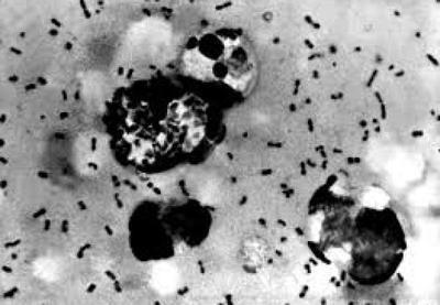 Caso de peste bubônica coloca China em alerta