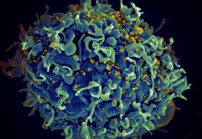 Cientistas relatam 3º caso mundial de eliminação de HIV