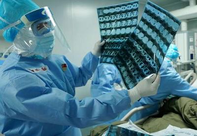 China denuncia novo vírus ainda mais letal que a Covid-19 no Cazaquistão