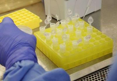 Cientistas descobrem novos anticorpos que neutralizam vírus da Covid-19