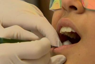 Cientistas descobrem como tratar cárie e fazer parte do dente se reparar naturalmente
