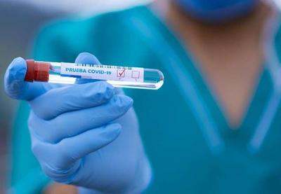 Coronavírus: Brasil tem 26 mil casos e 1.156 novas mortes confirmadas