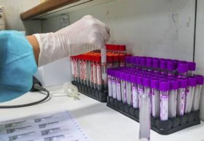 Coronavírus: UFRJ desenvolve teste sorológico 20 vezes mais barato