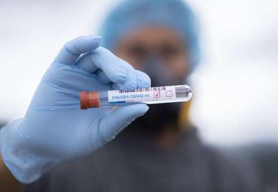 Coronavírus: vacina deve ser produzida ainda em 2020 na Alemanha e EUA