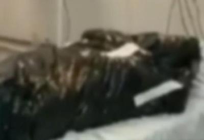 Corpo de vítima de covid-19 é embalado em saco plástico em UTI no DF