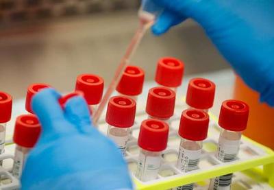 Covid-19: Conep aprova terceira fase de testes da vacina em SP