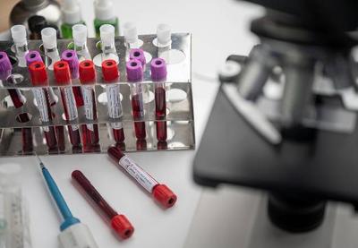 Covid-19: testes da vacina de Oxford são suspensos após voluntário ter reação adversa